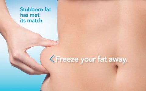 Hips treatment Nottinghamshire From Lipo Sculpt