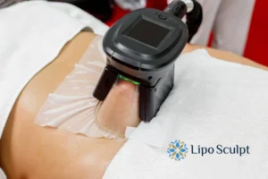 Cryolipolysis Helping You Getting that Perfect Summer Body 3 Cryolipolysis Nottinghamshire can give you the best summer body - contact us today!