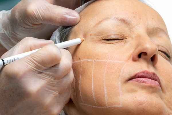 CryoPen: 5 Skin Concerns It May Be Used to Treat 4 What should you ask before having CryoPen treatment Nottinghamshire?