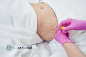 Are The Results From Aqualyx Permanent? 1 Do you want to know how long Aqualyx Nottinghamshire results last?