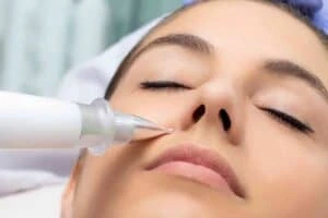 Best Actinic Keratoses Removal 3 Actinic keratoses Nottinghamshire solutions - book in today!