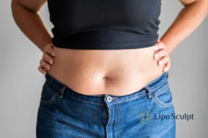 Bidding Farewell to Muffin Tops with Aqualyx Fat Injections 2 Do you wish you could reduce your muffin top Nottinghamshire With Aqualy fat dissolving injections you can!